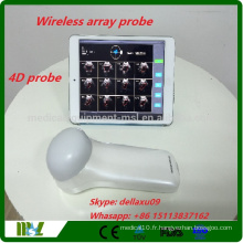 2016 Nouvelle marque 4D Wireless Bladder Scanner Protable vessie scanneur à ultrasons travail avec iphone / ipad / andriod MSLPU37A